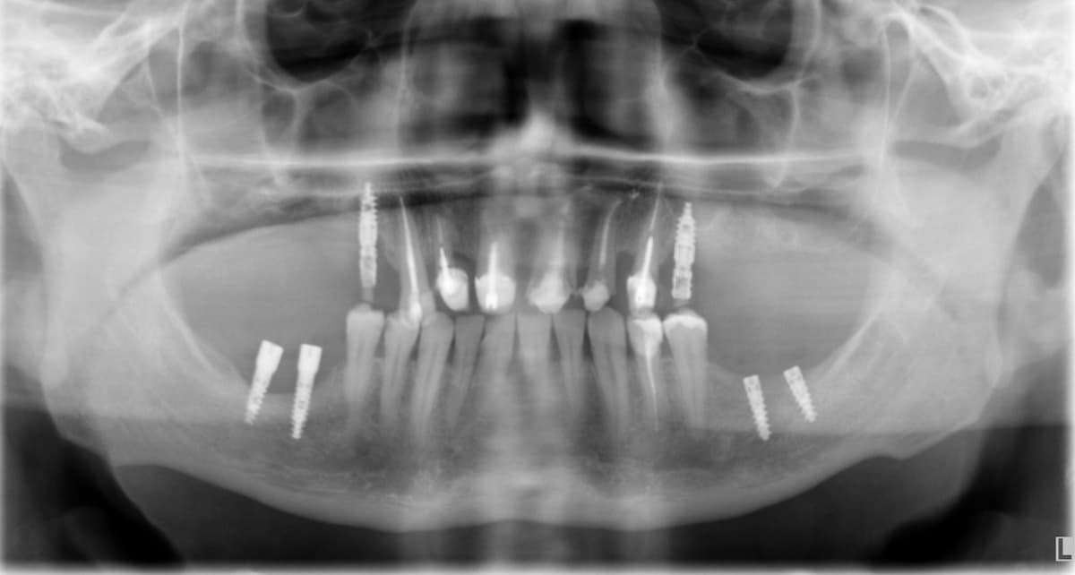 DSS - Caso 01 - Radiografía 1